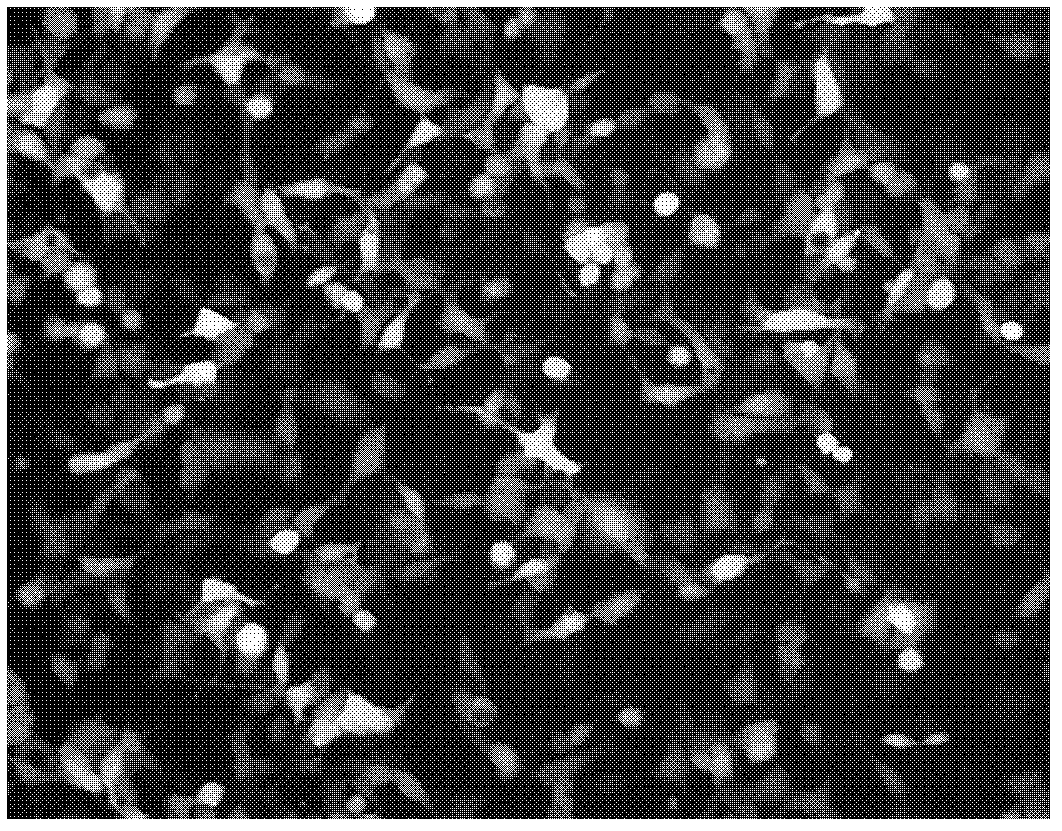 Delta-6 fatty acid dehydrogenase mutant gene and expression carrier and application thereof