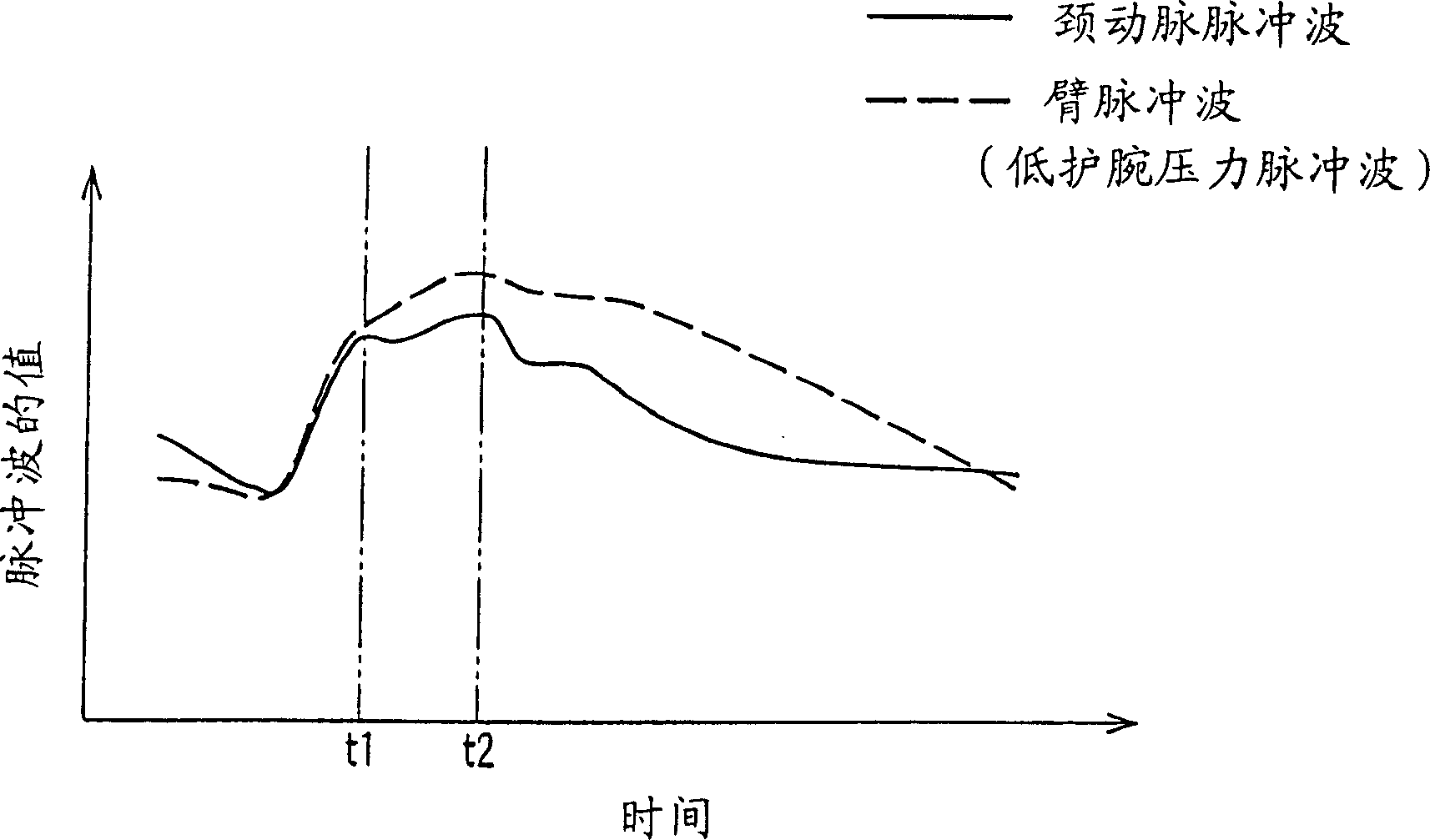 Increment index determining equipment and arteriosclerosis checking equipment