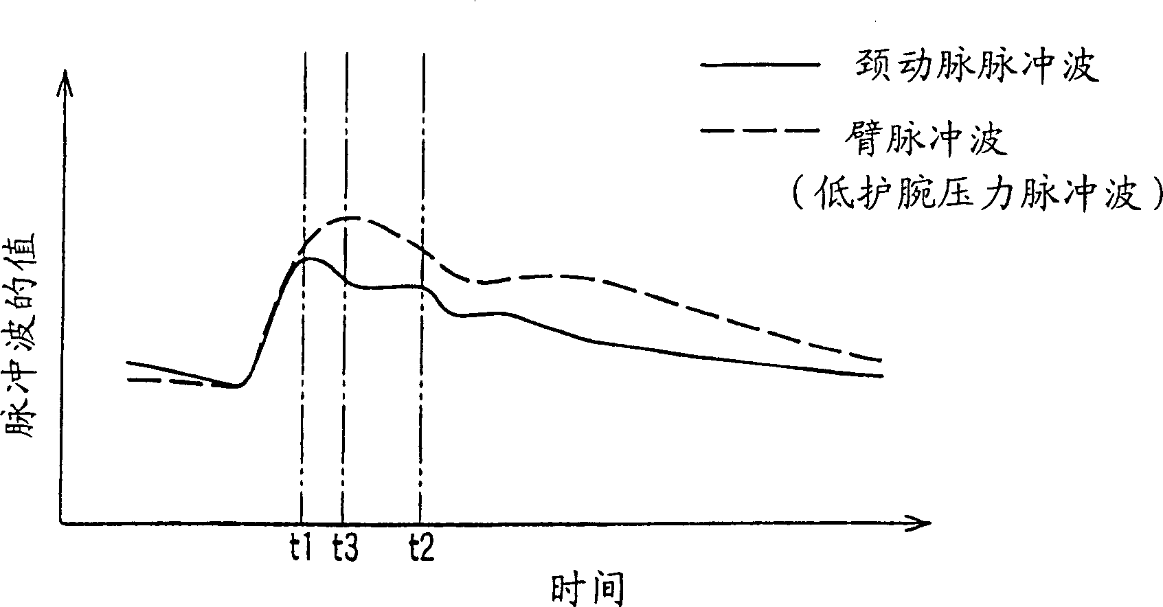 Increment index determining equipment and arteriosclerosis checking equipment