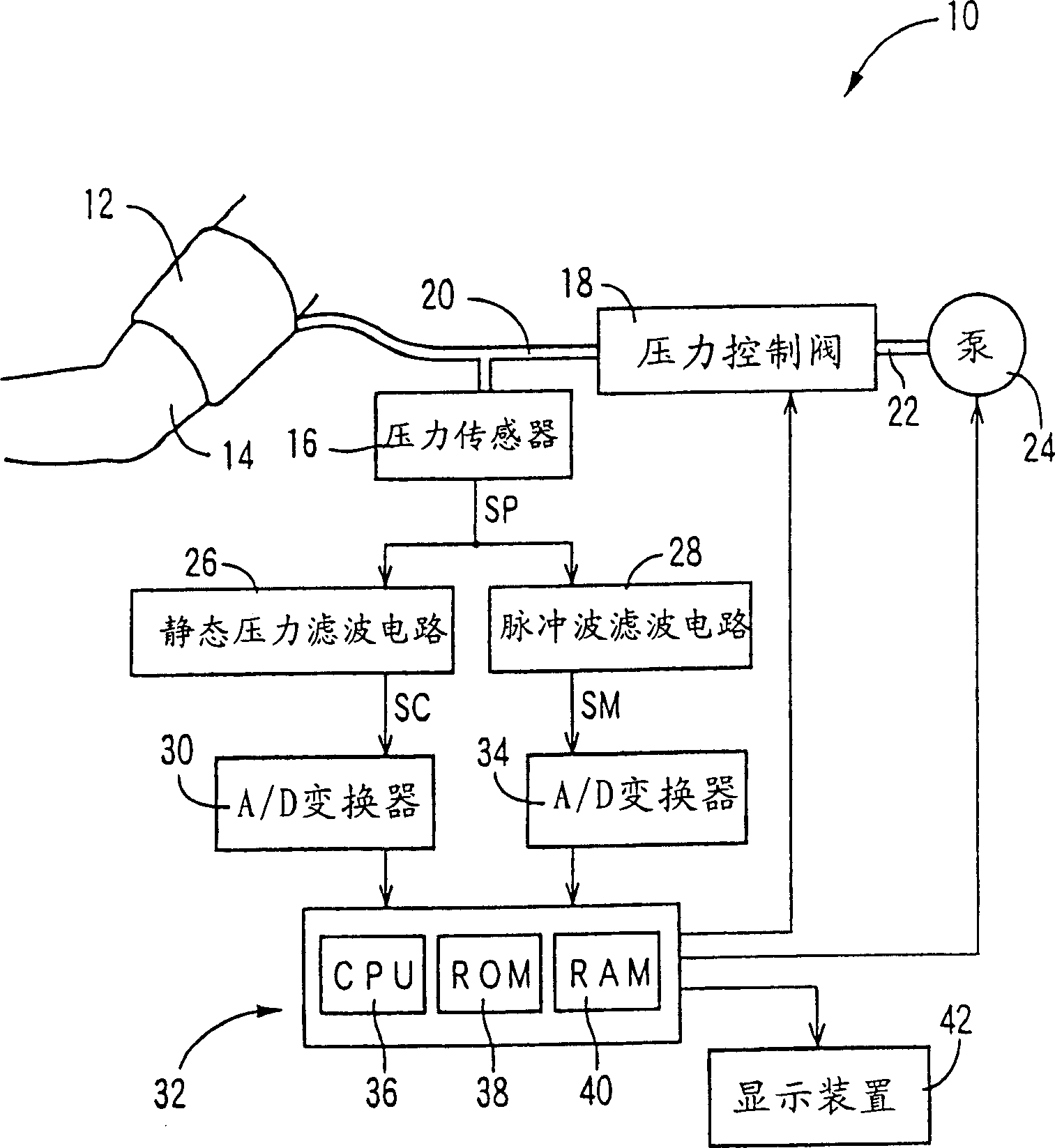 Increment index determining equipment and arteriosclerosis checking equipment