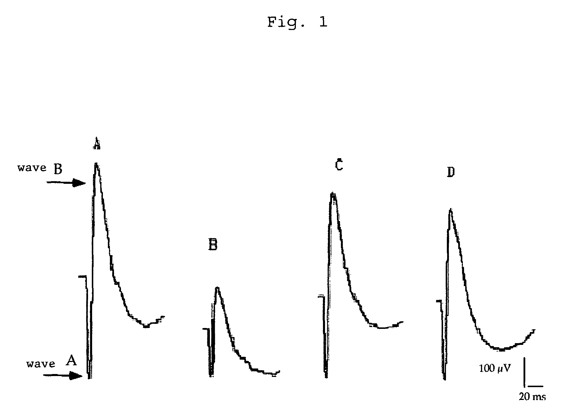 Method of treatment of retinal ischemia with diazoxide