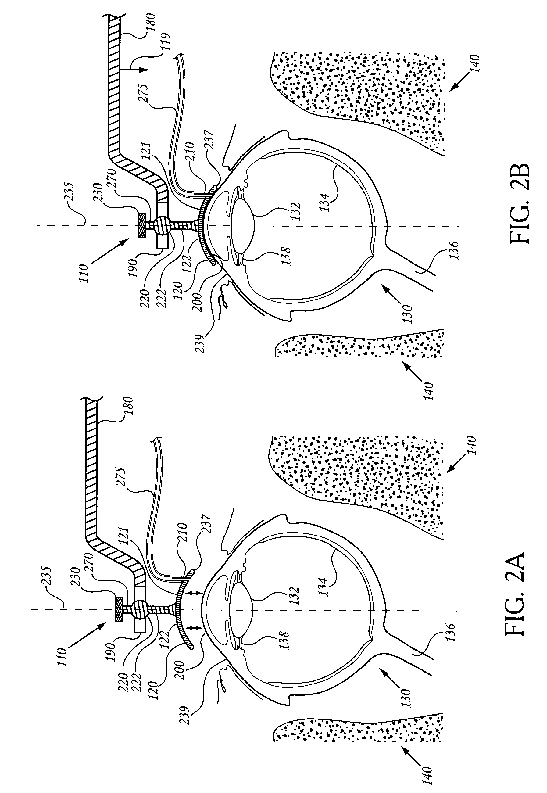 Device and assembly for positioning and stabilizing an eye