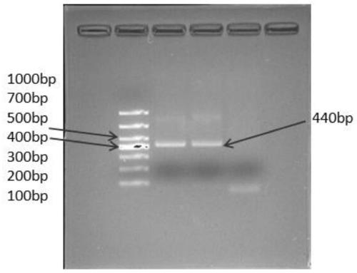 Preparation method of goose gout yolk antibody