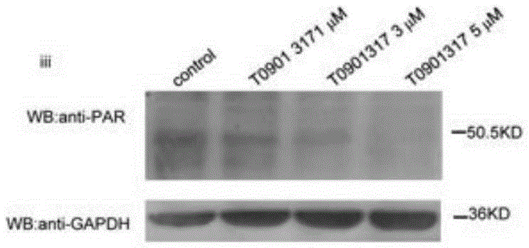 Application of T0901317 serving as PARP1 inhibitor