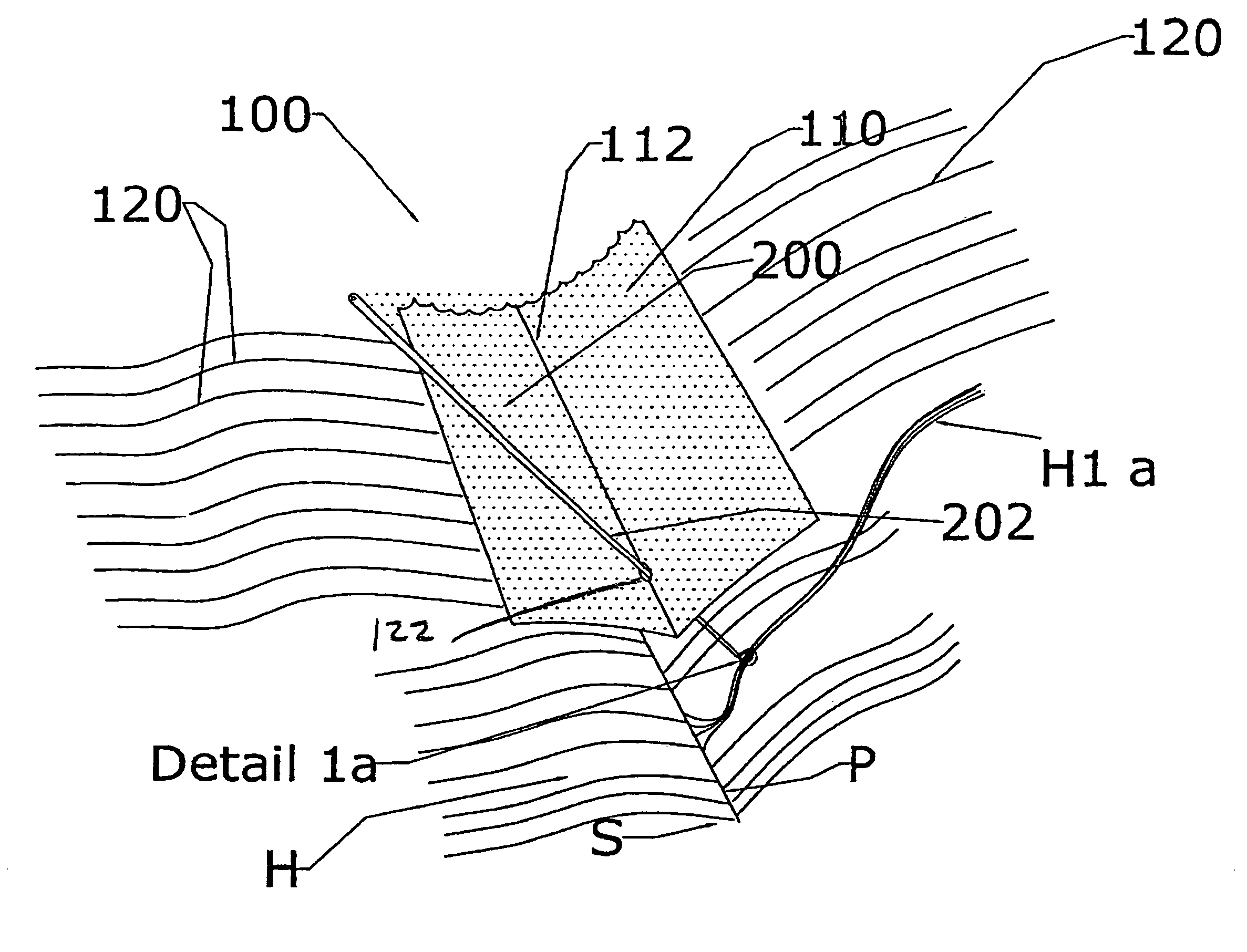 Method and apparatus for securing a hair extension