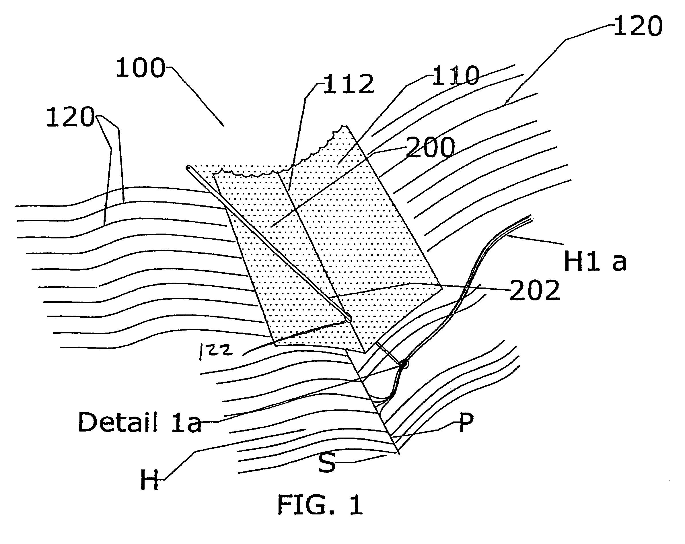 Method and apparatus for securing a hair extension