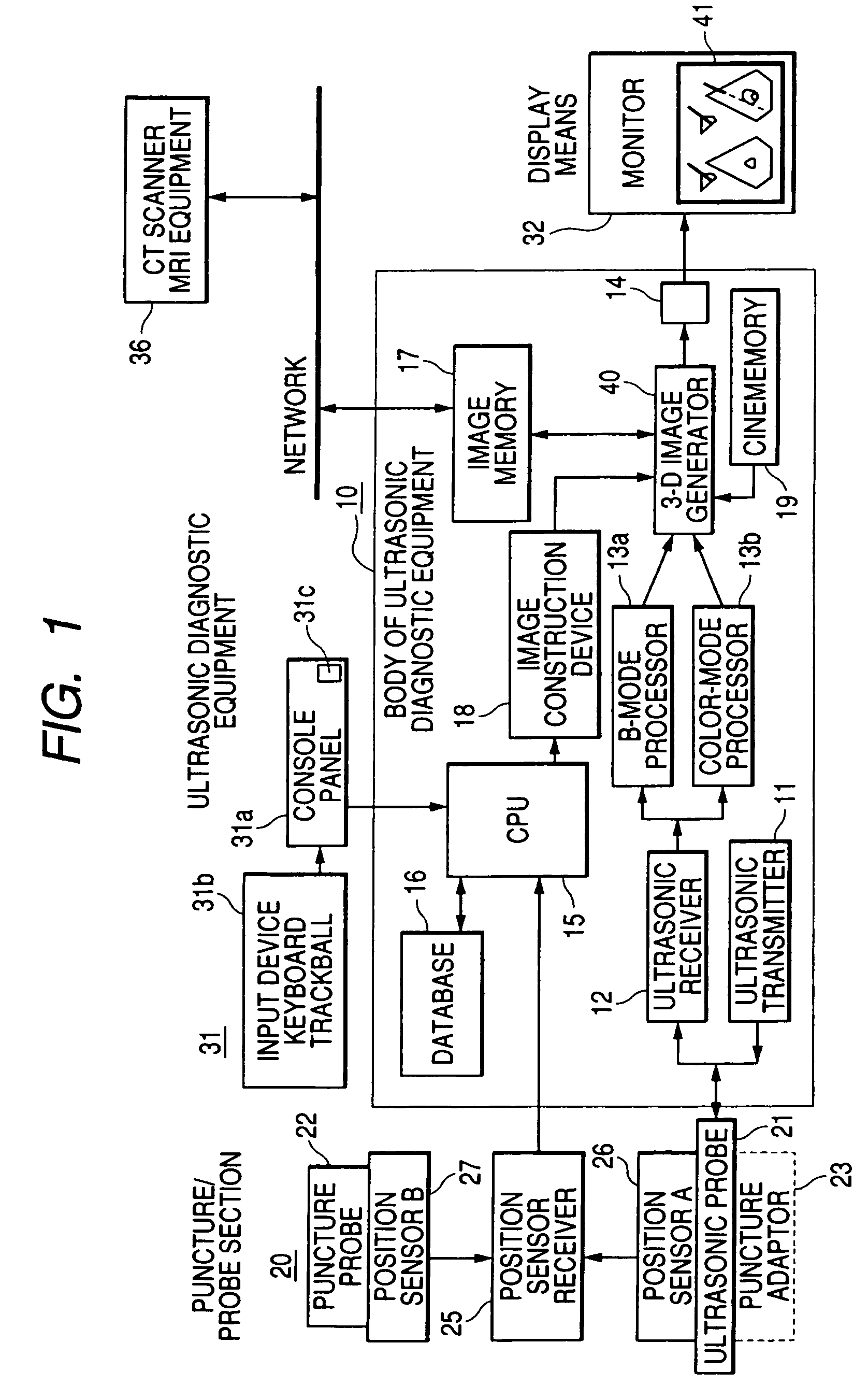 Ultrasonic diagnostic apparatus