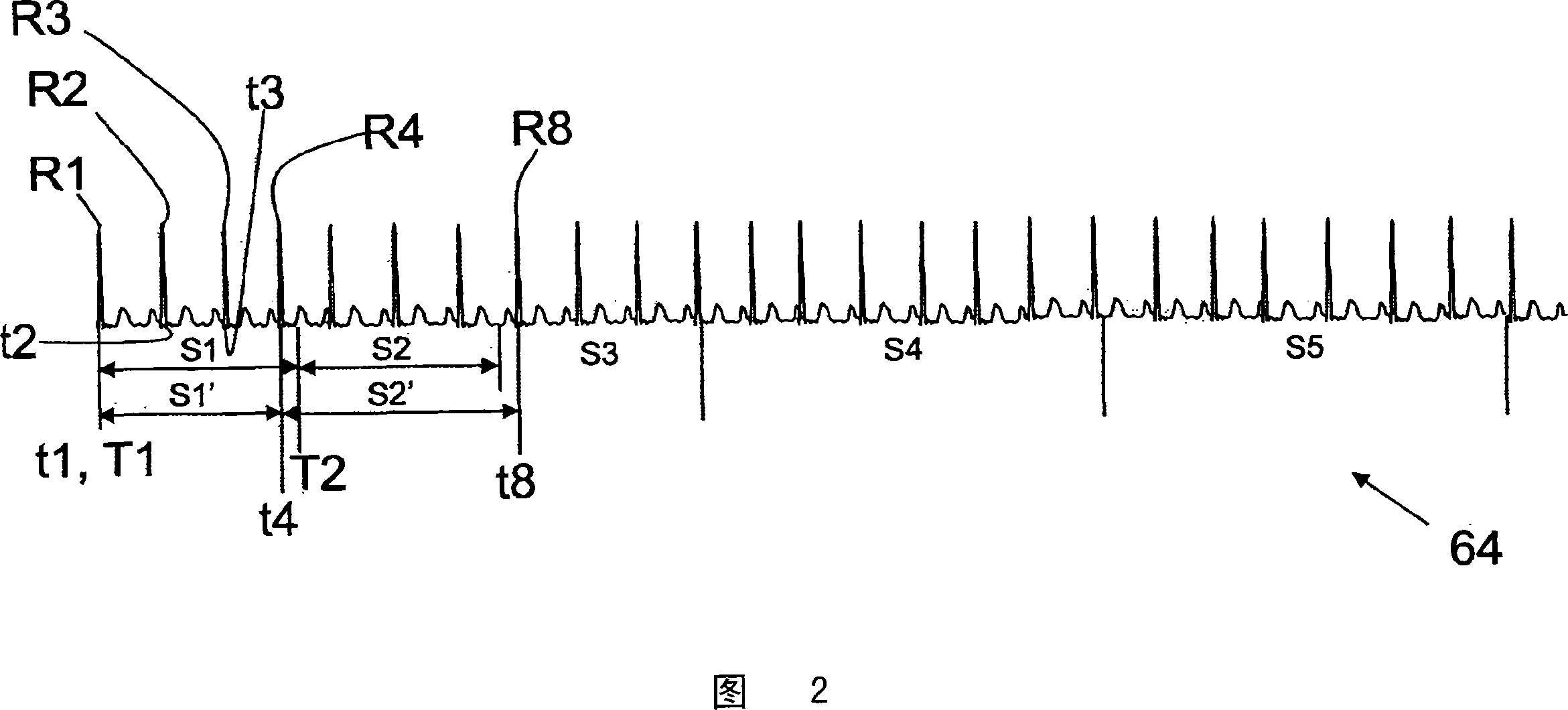 ECG-gated temporal sampling in cardiac kinetic modeling