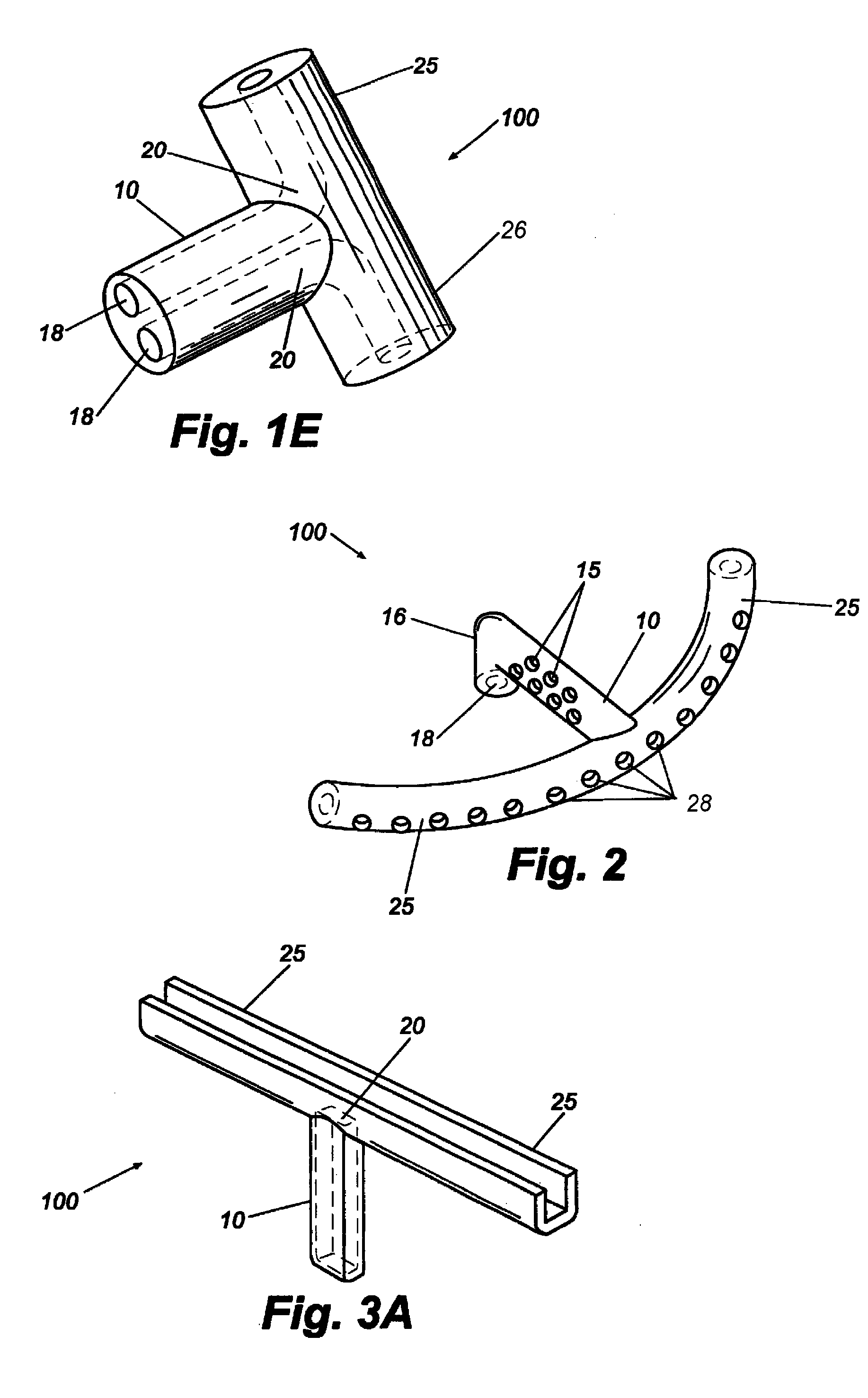 Dual drainage pathway shunt device and method for treating glaucoma