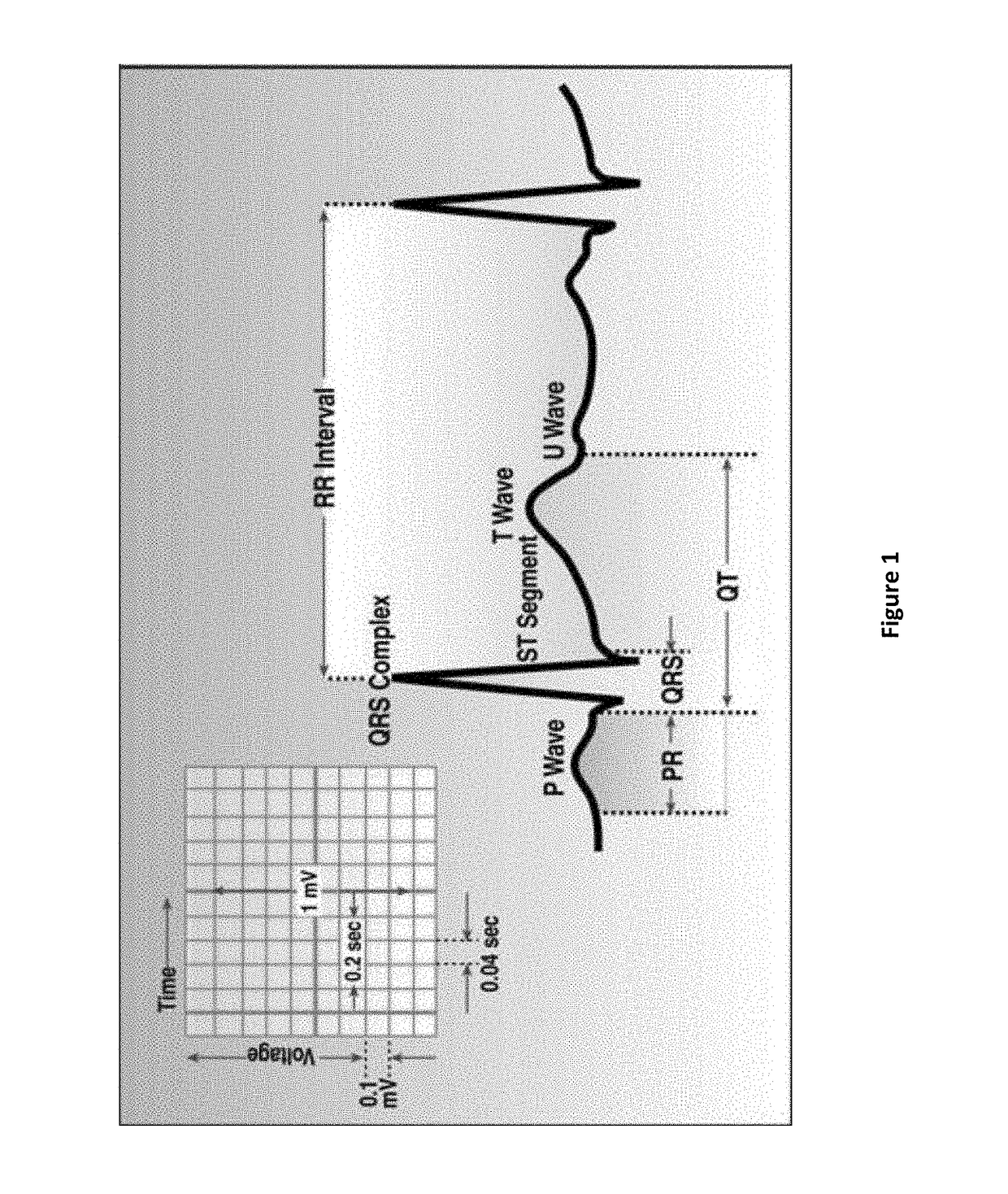 Compositions and methods for treating atrial fibrillation