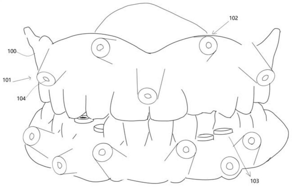 Occlusion-oriented implant surgery device for missing dentition and preparation method thereof