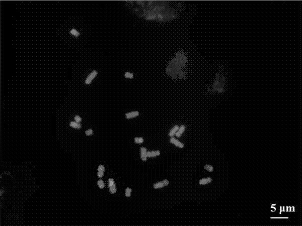 Method for preparing asparagus root tip cell chromosome metaphase split-phase specimen