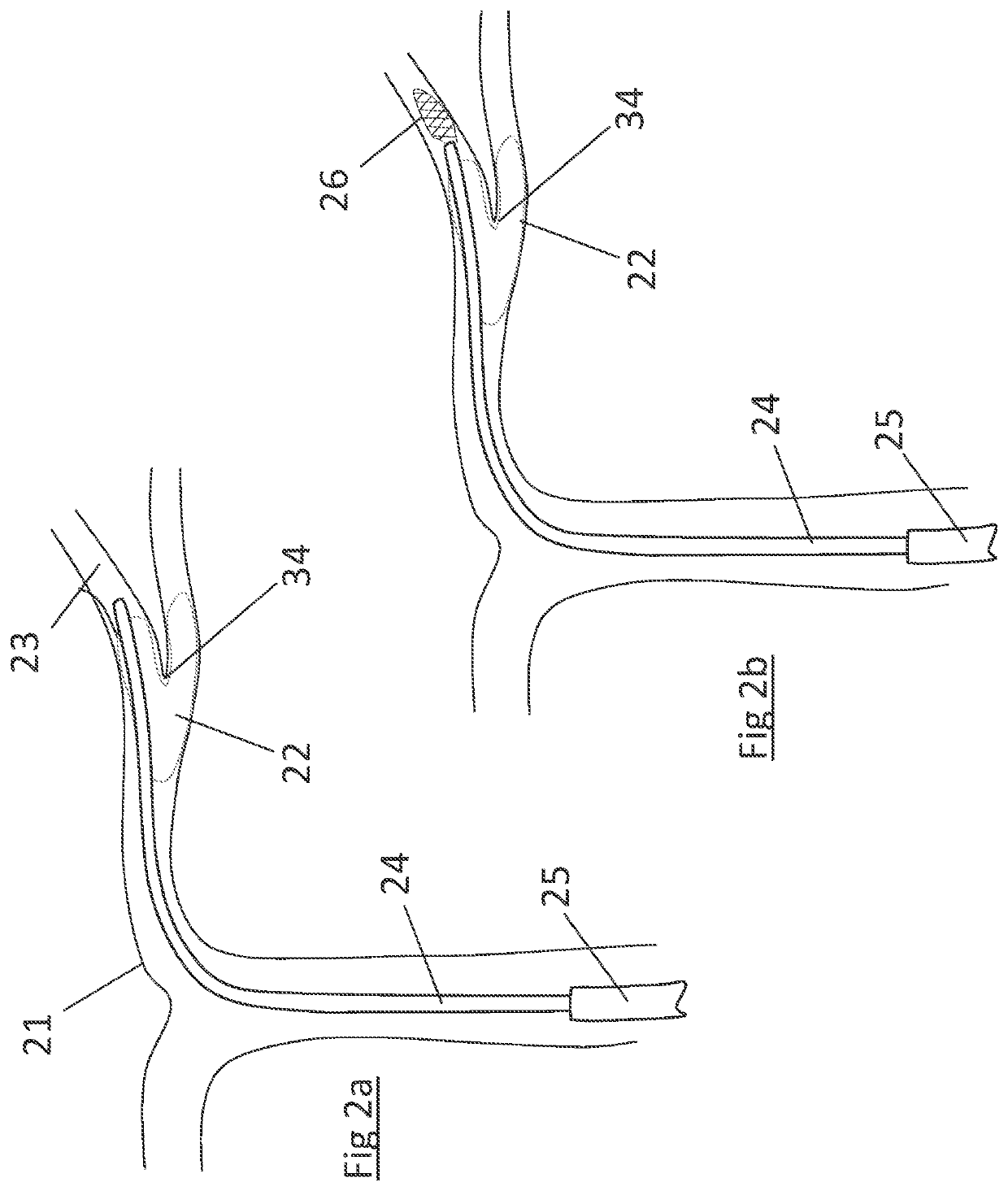 Clot retrieval device for removing occlusive clot from a blood vessel