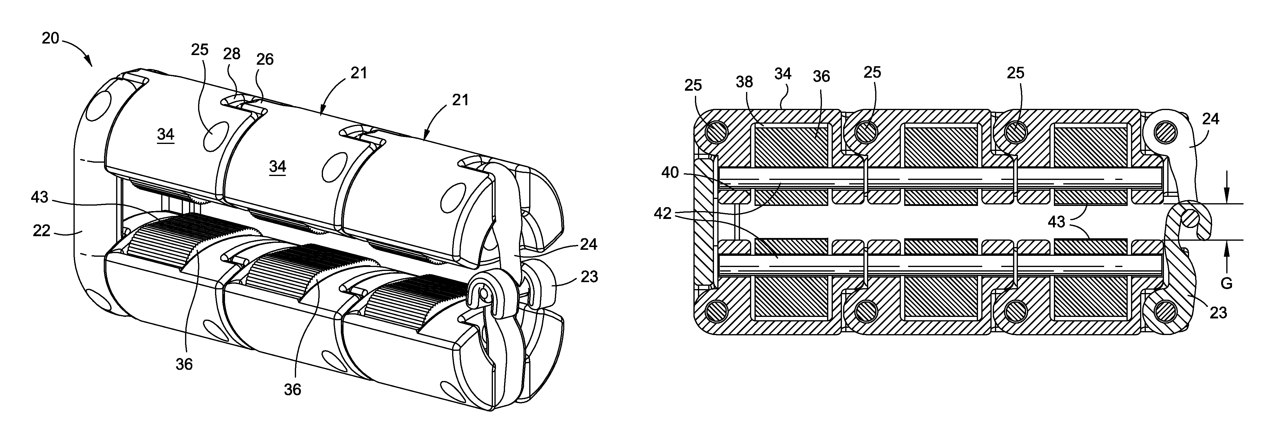 Articulated gastric implant clip