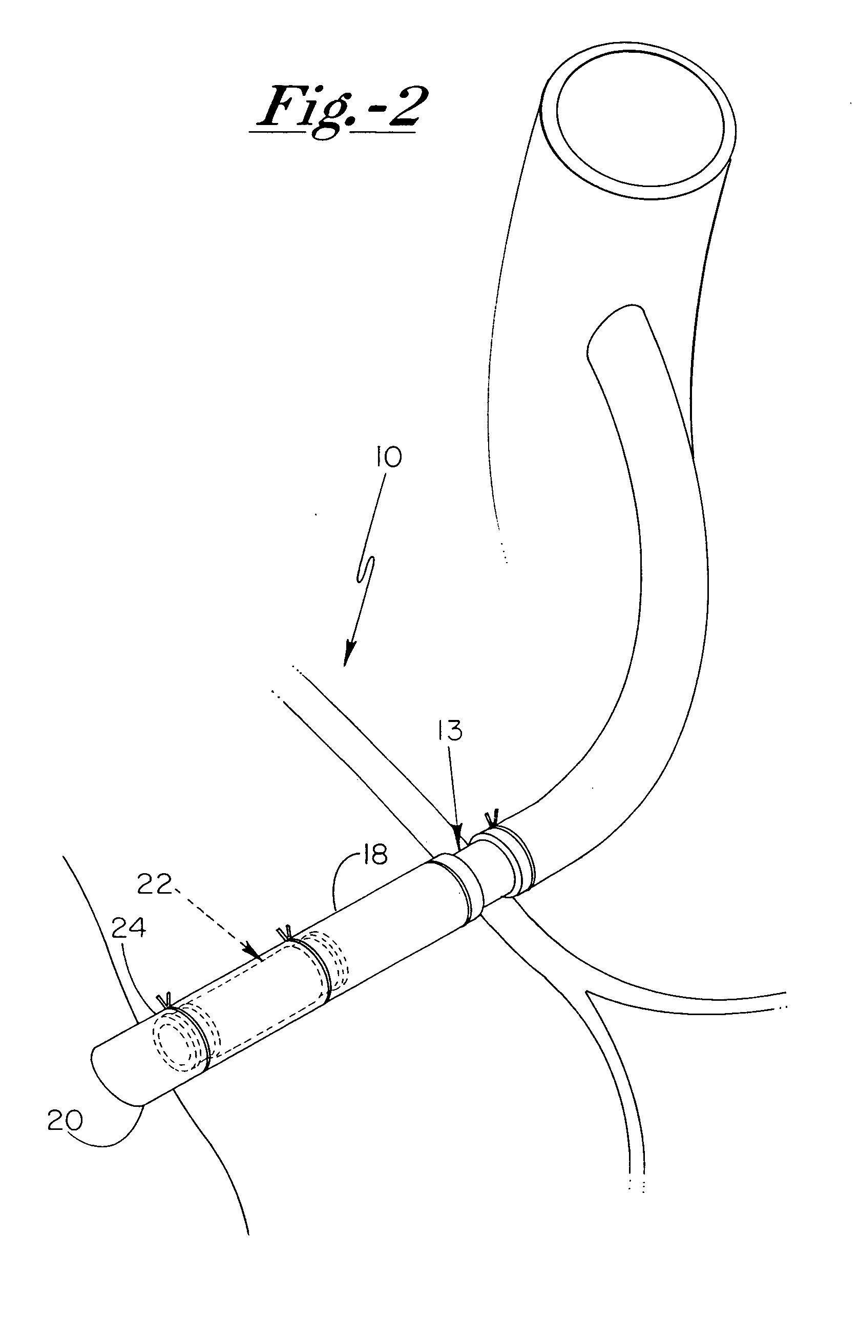 Grafted network incorporating a multiple channel fluid flow connector