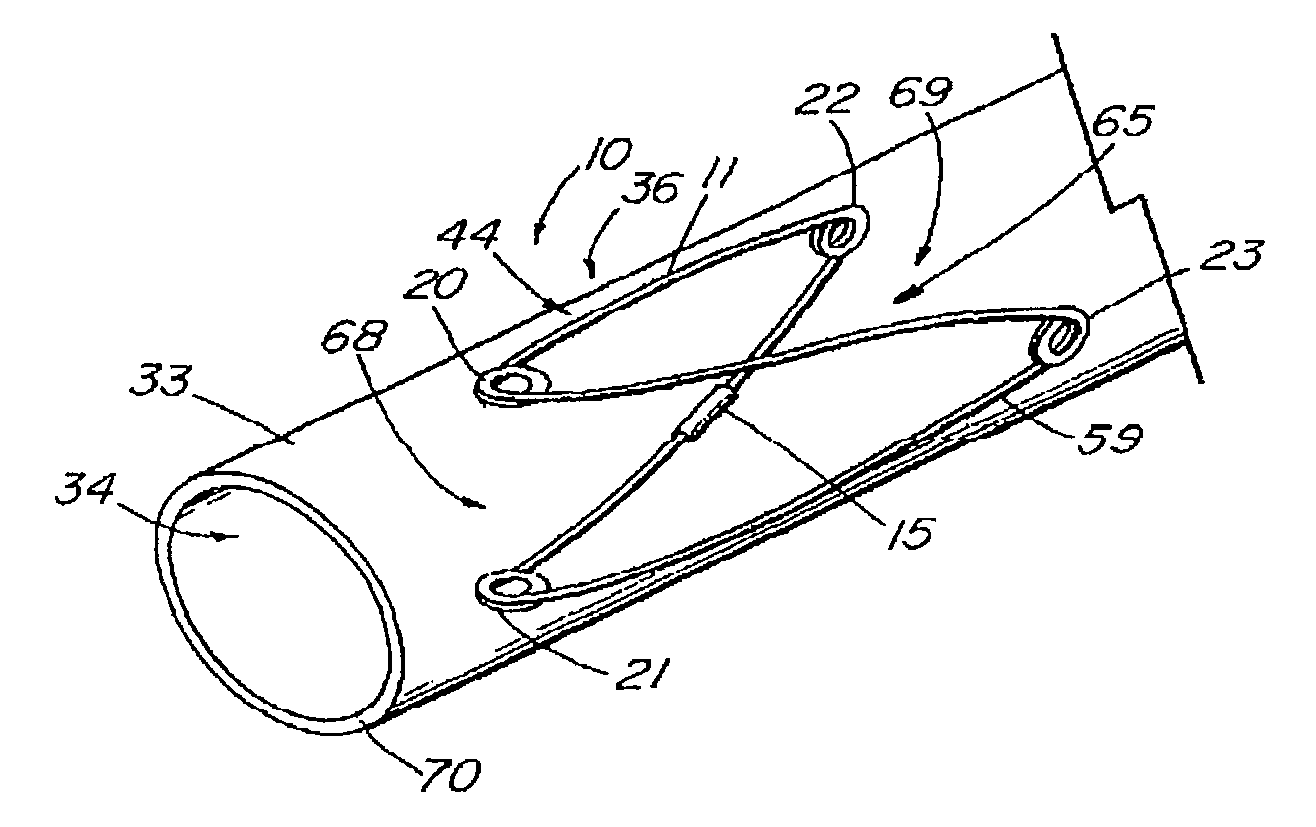 Stent and method of forming a stent with integral barbs