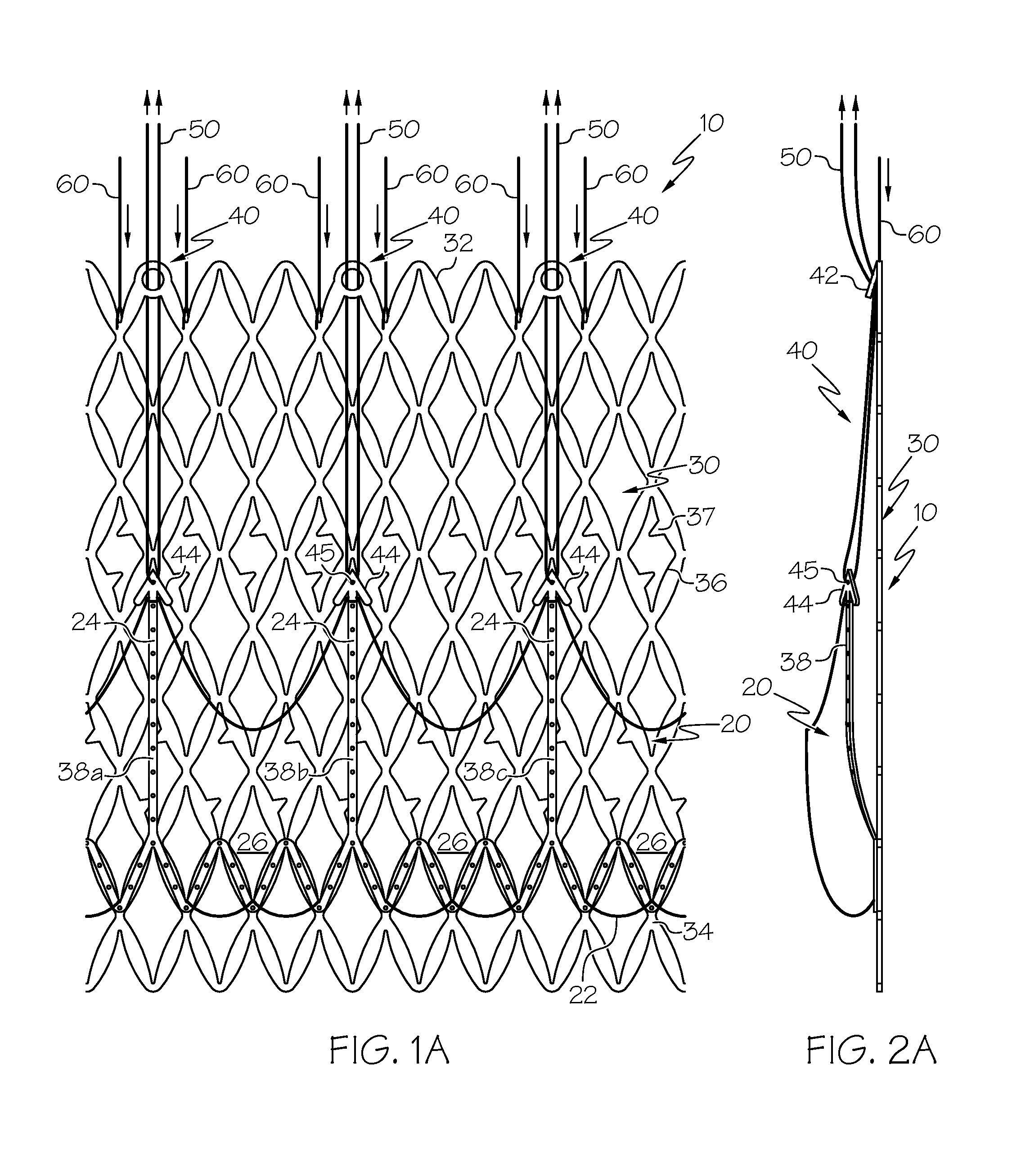 Repositionable Heart Valve and Method