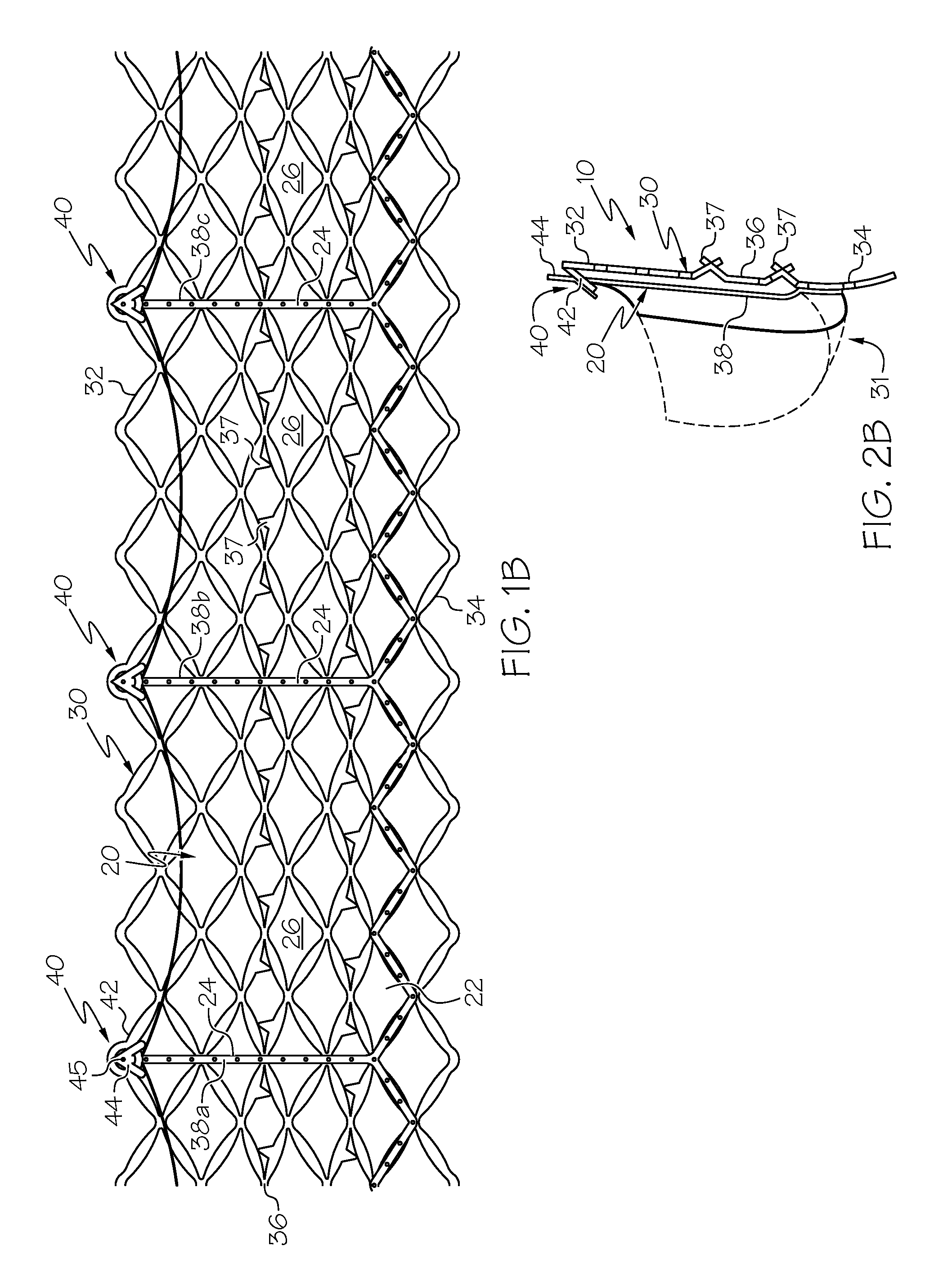 Repositionable Heart Valve and Method