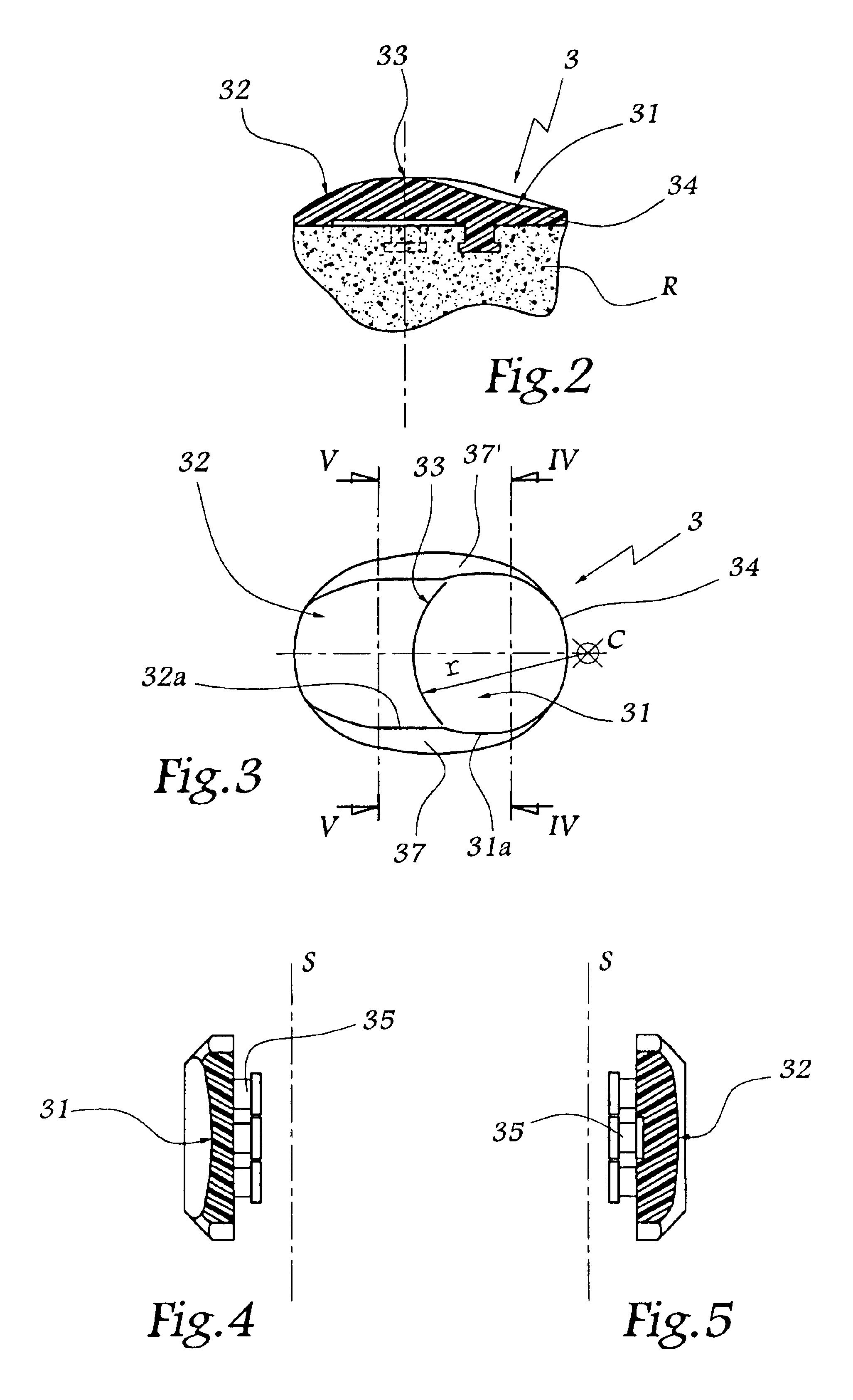 Patellar implant and knee prosthesis incorporating such an implant