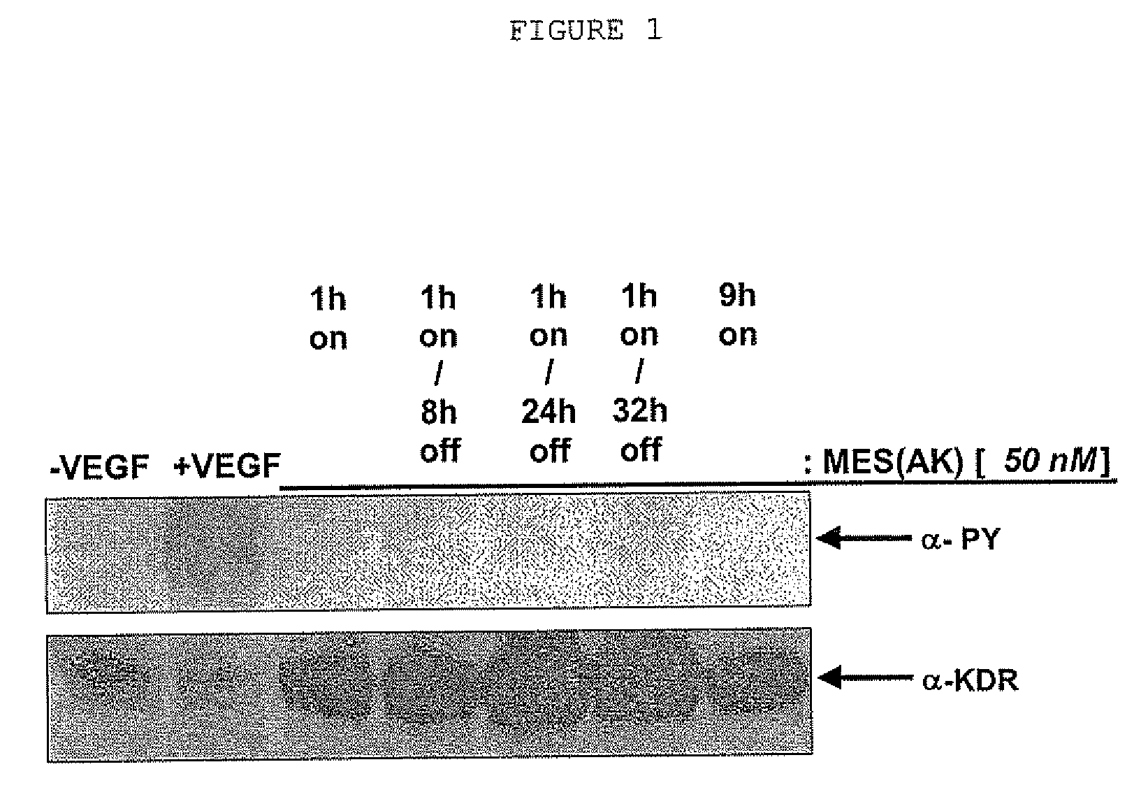 Combinations for the treatment of diseases involving cell proliferation, migration or apoptosis of myeloma cells or angiogenesis