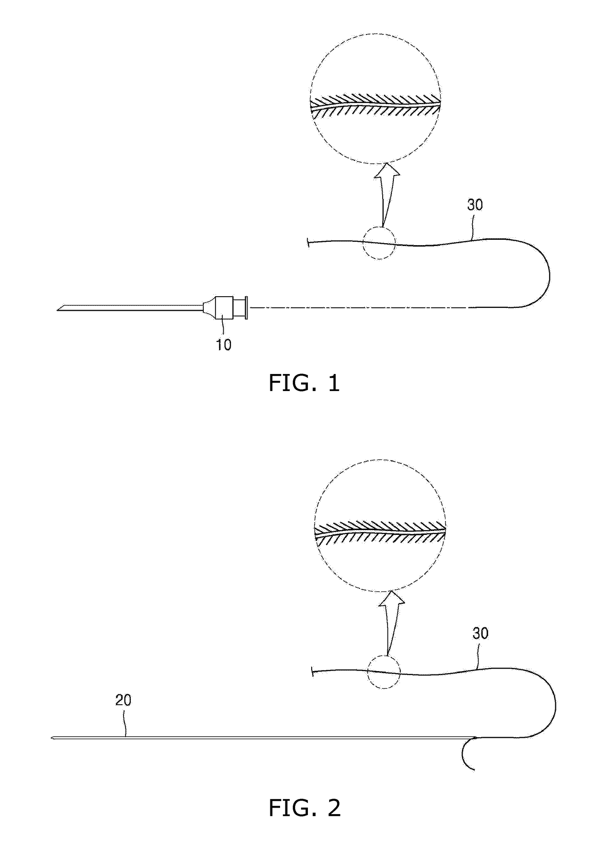 Lifting surgical instrument having branch point
