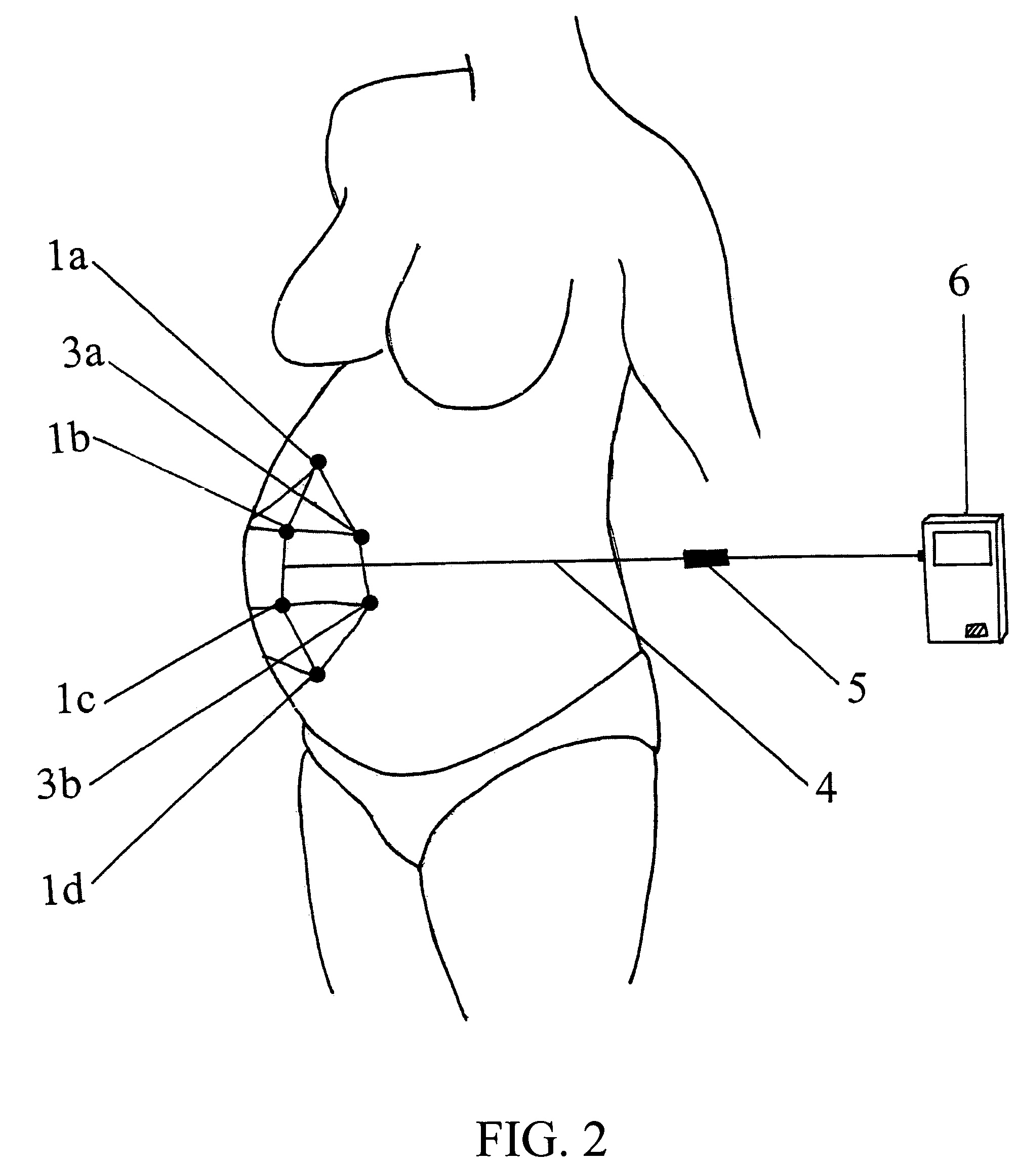 Maternal-fetal monitoring system