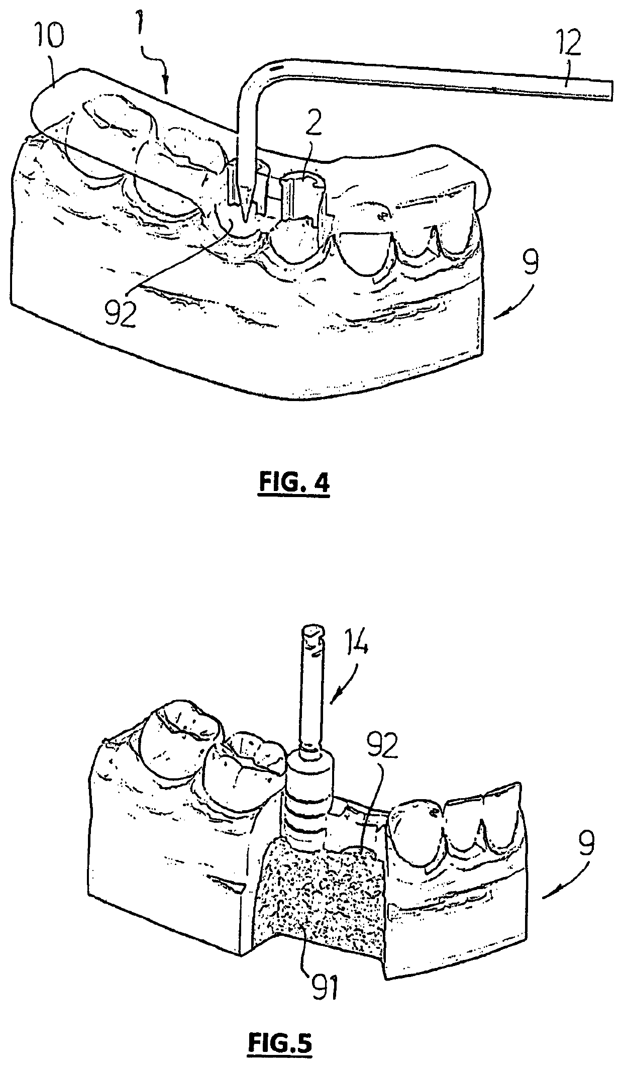 Surgical guide system for dental implantology and method for making the same