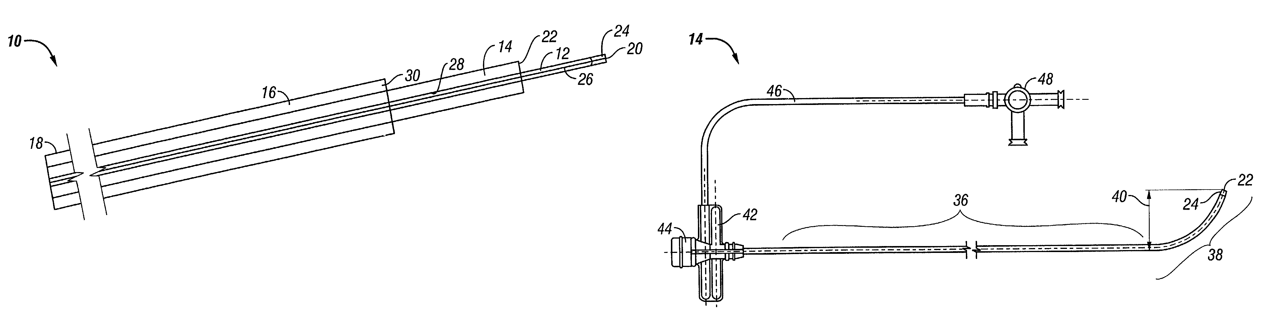 Telescopic, separable introducer and method of using the same