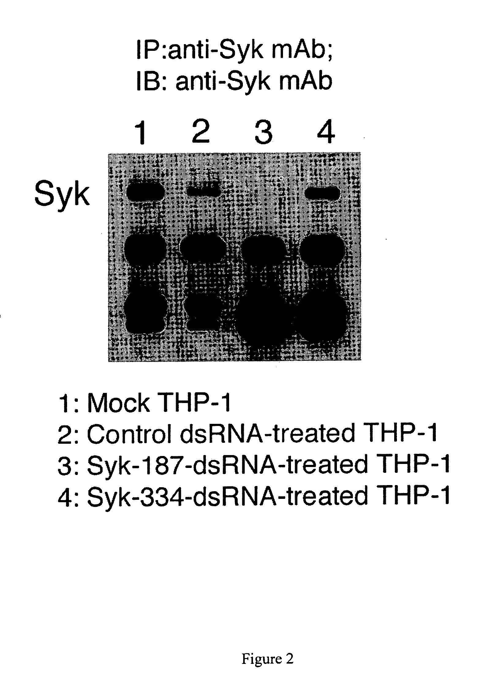 Syk-targeted nucleic acid interference