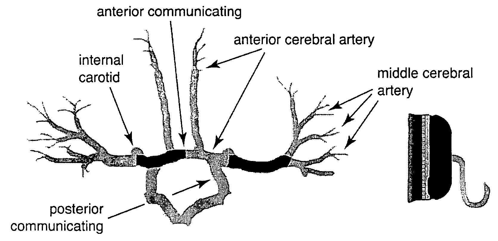 Methods for determining intracranial pressure non-invasively