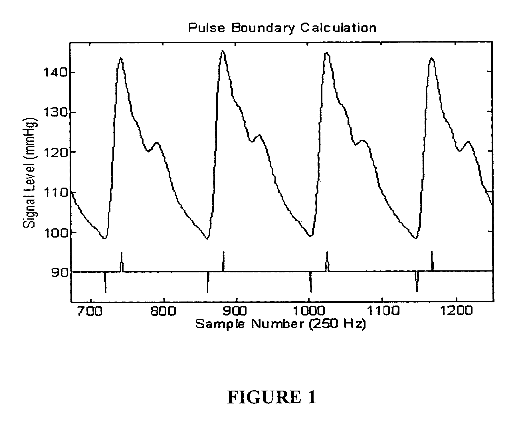 Methods for determining intracranial pressure non-invasively