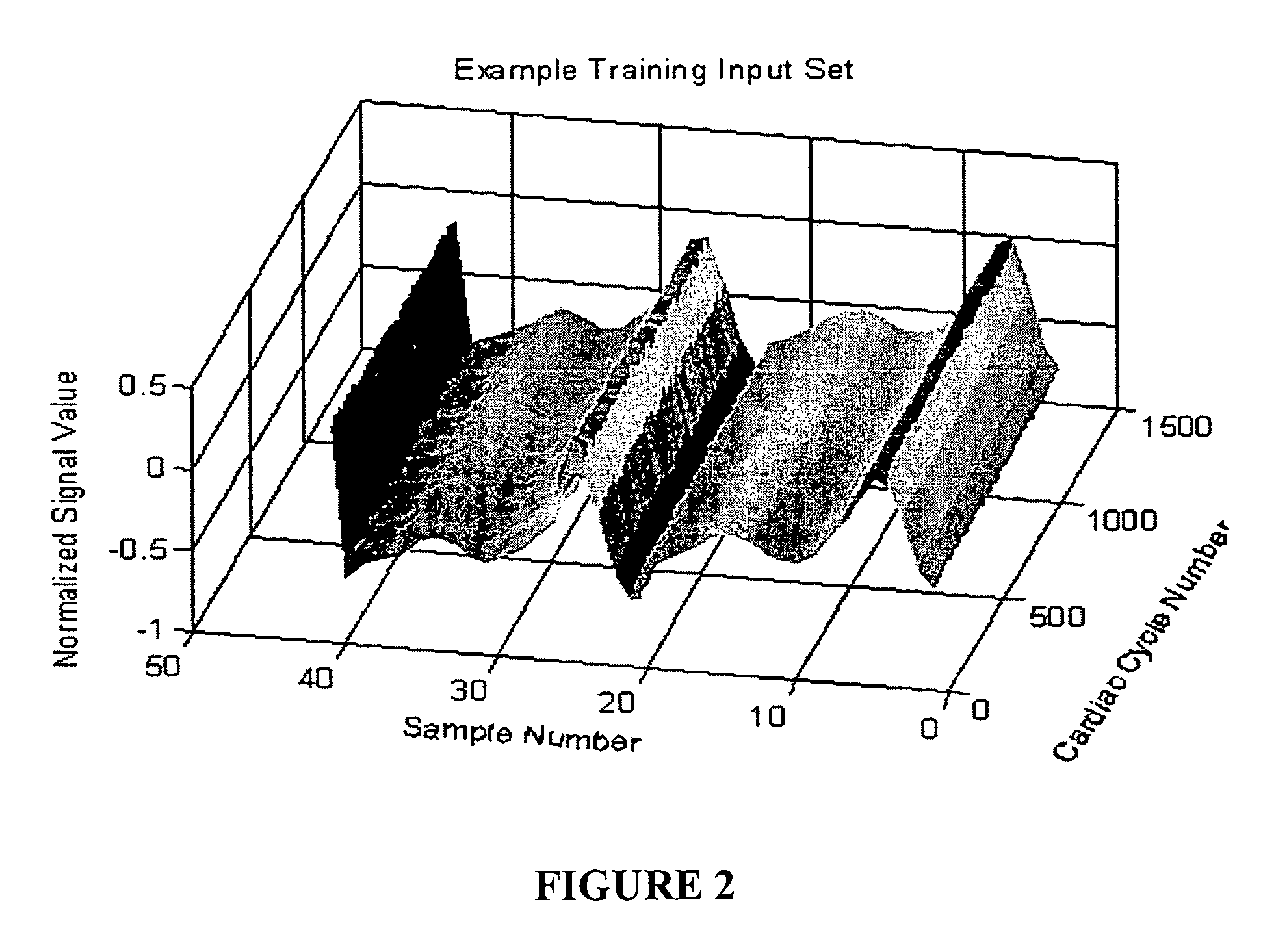 Methods for determining intracranial pressure non-invasively