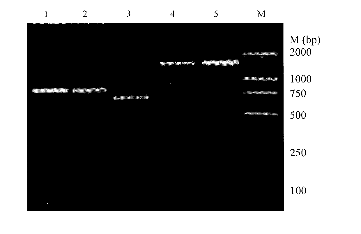 Antibody to beta-amyloid peptide and application thereof