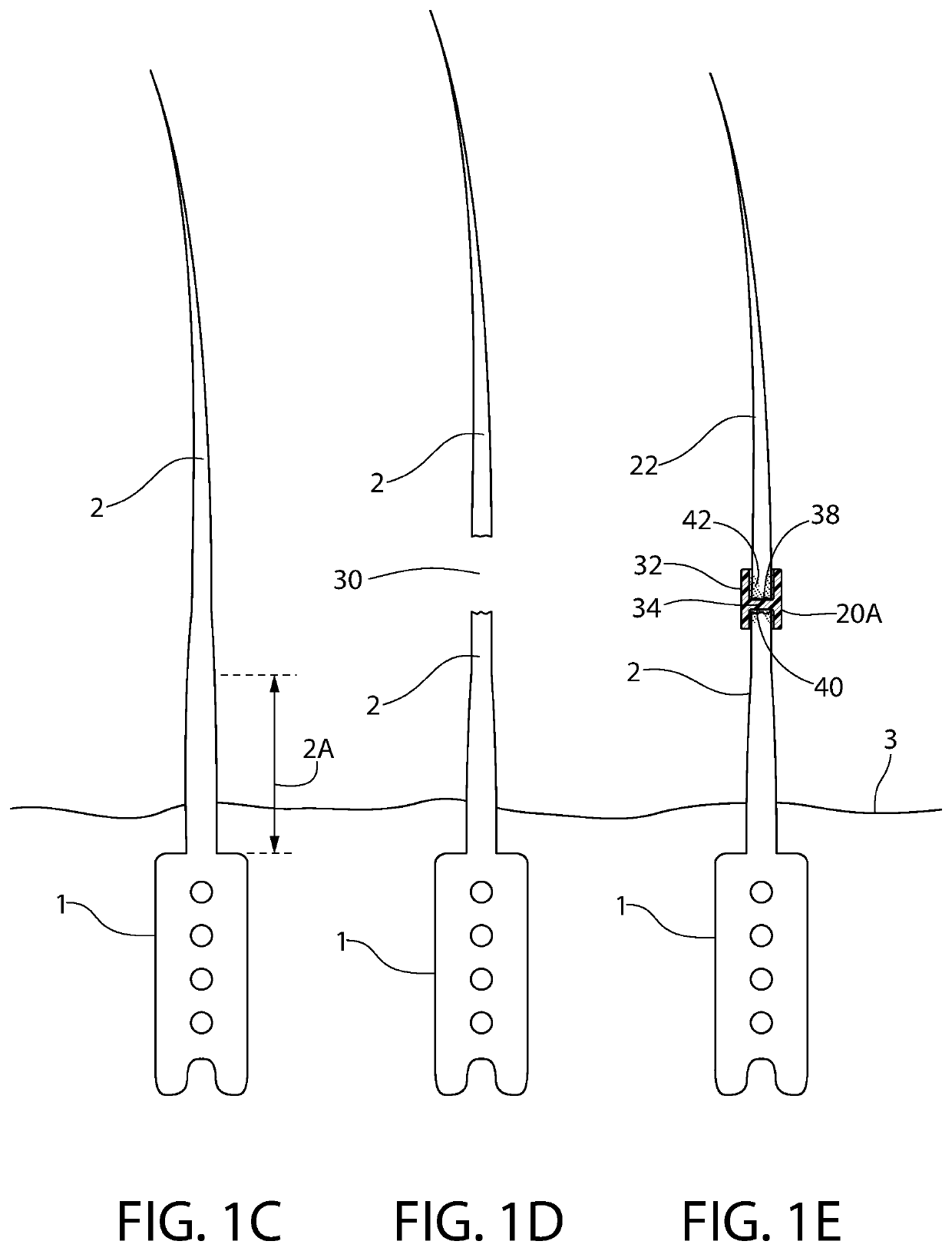 Extension apparatus for artificial hair implants