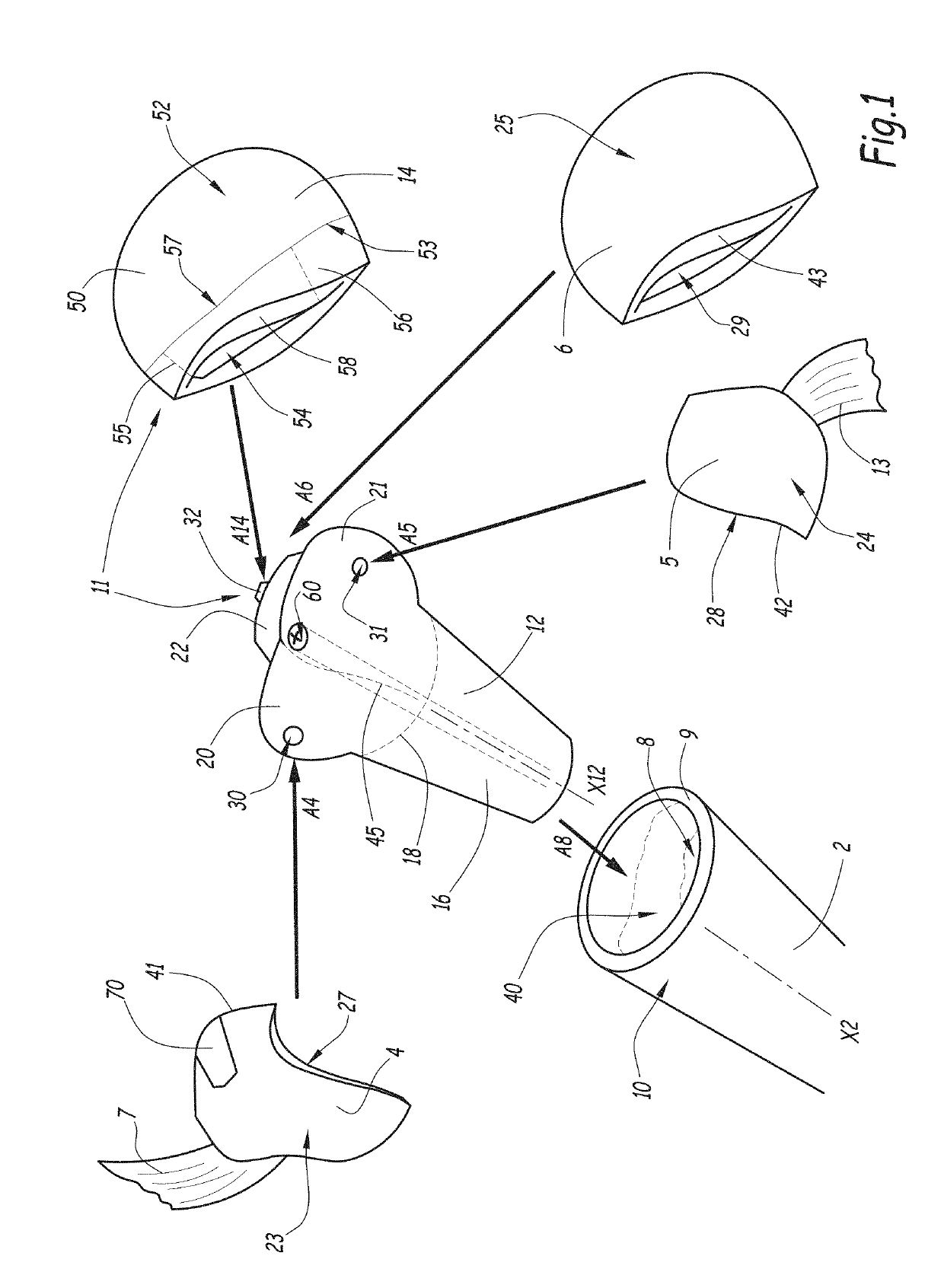 Method for manufacturing a patient-specific prosthesis for a fractured long bone