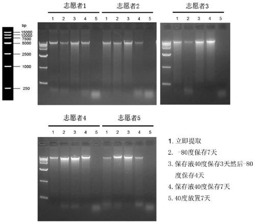 Genital tract flora nucleic acid preservation solution formula and preparation and application method