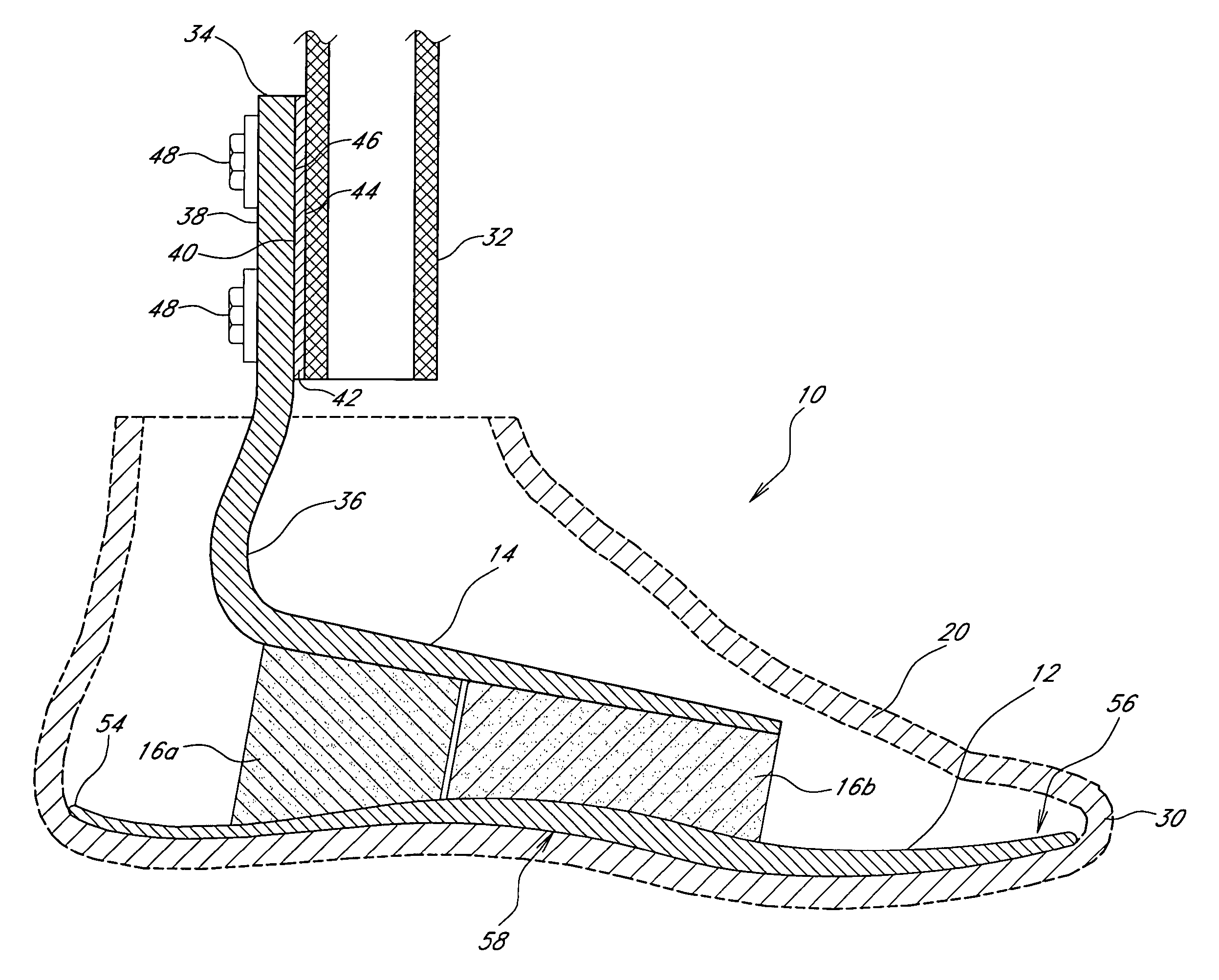 Foot prosthesis having cushioned ankle