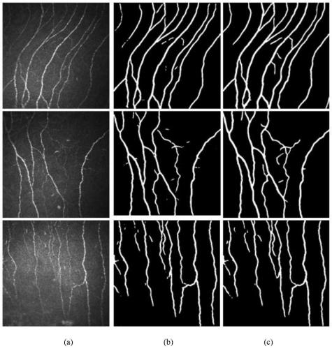 U-shaped network and segmentation method of nerve fibers in cornea image