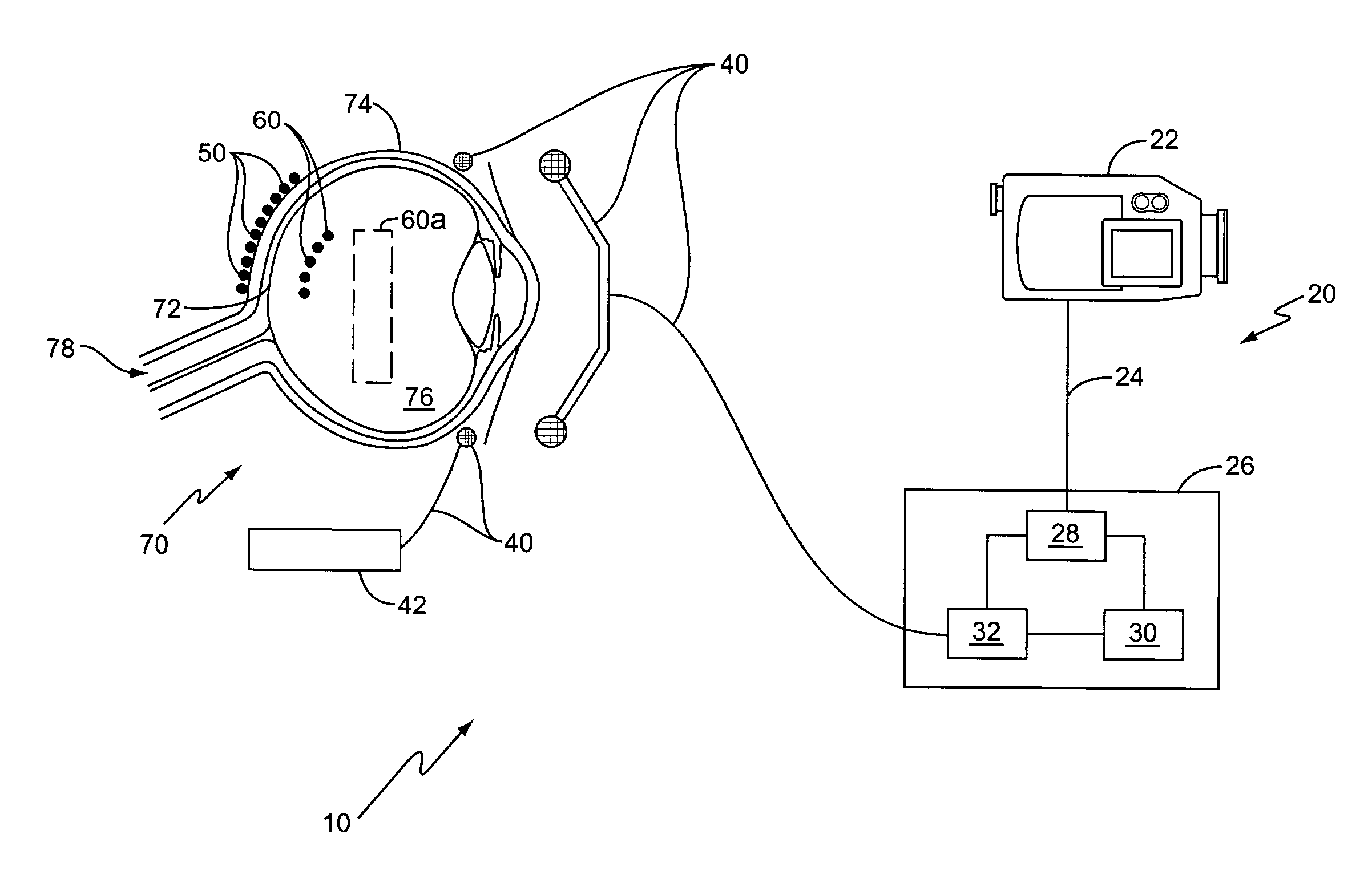 Vision prosthesis for the blind and method for implementing same