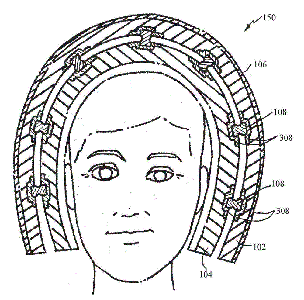 Helmet omnidirectional energy management system