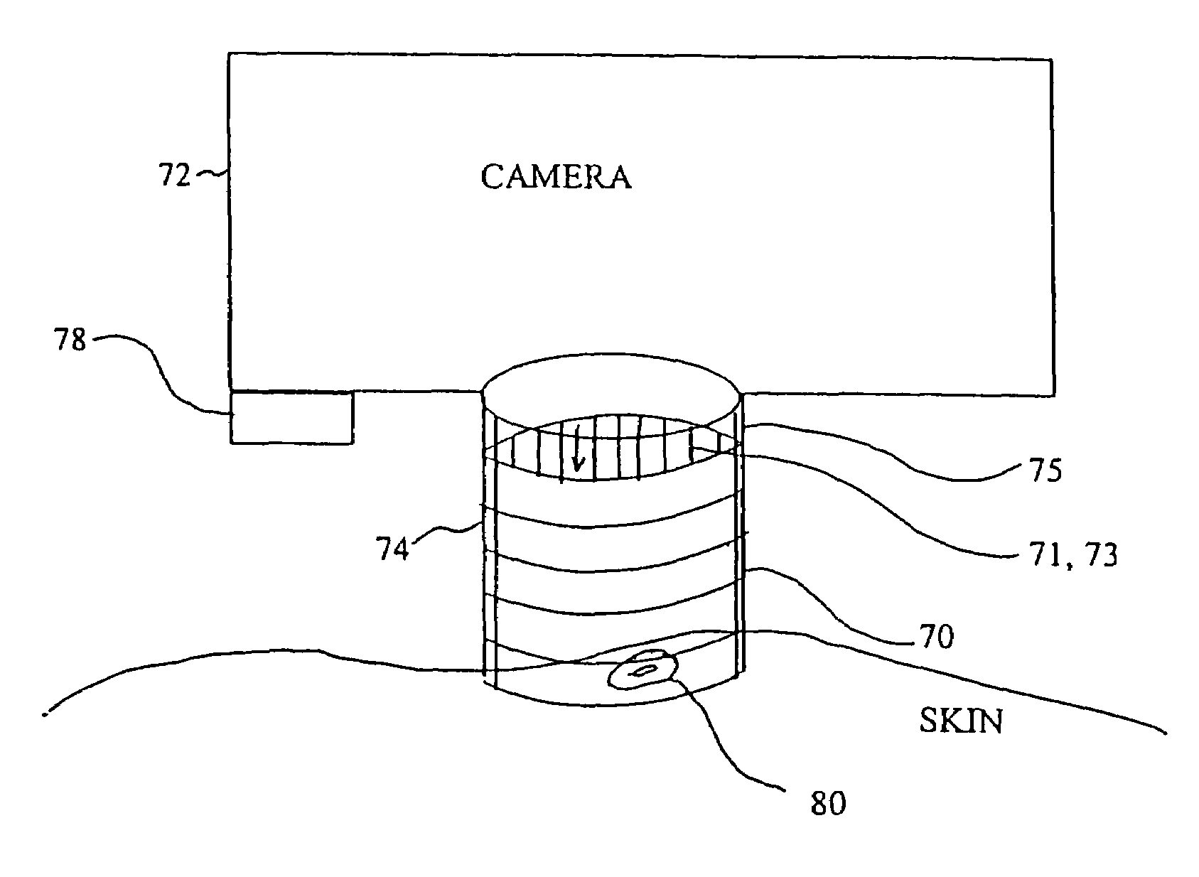 Method and device for skin cancer screening