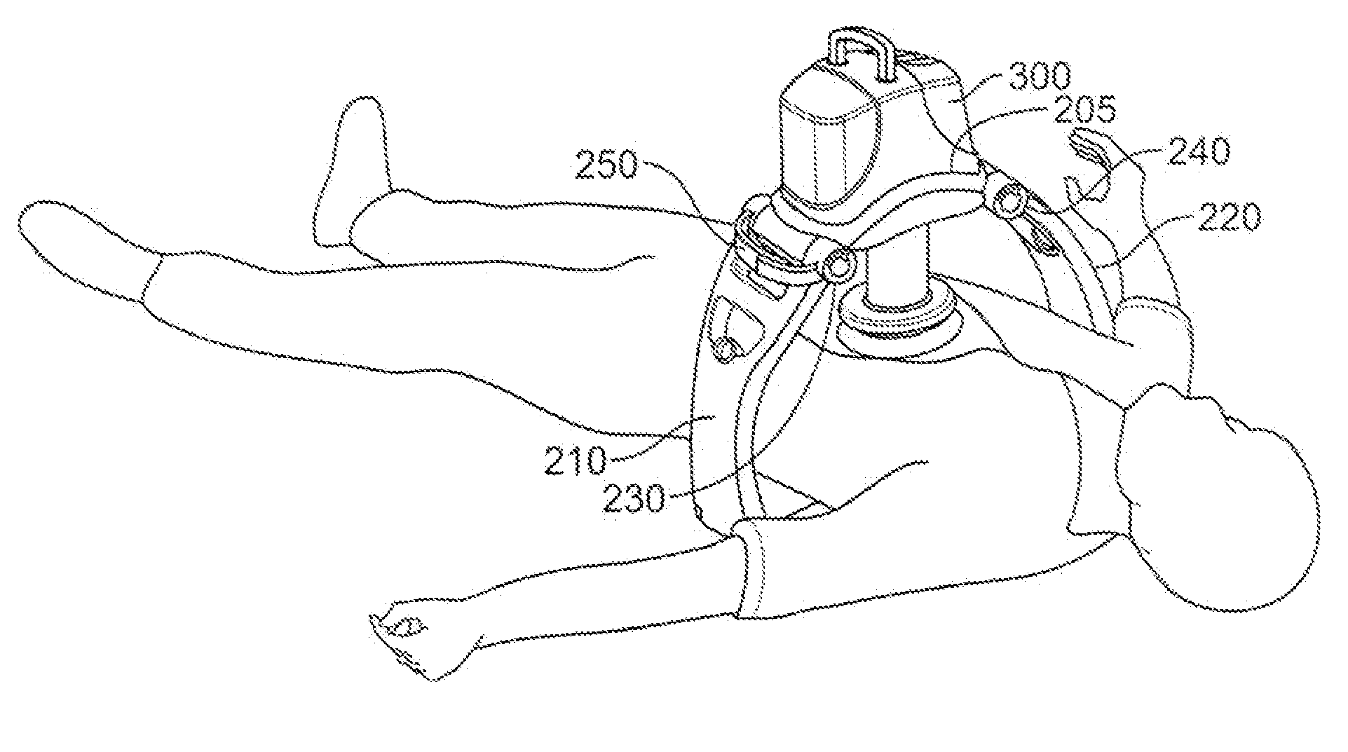 Rigid support structure on two legs for CPR