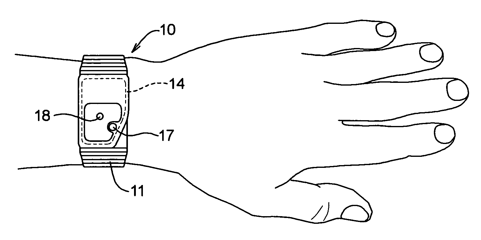 Systems and methods for detecting symptoms of hypoglycemia
