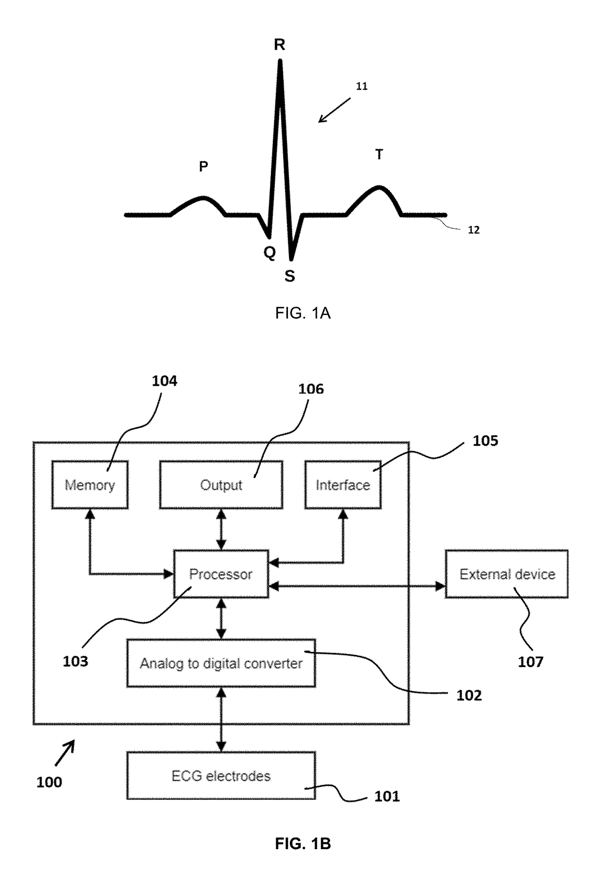 System and method for ECG signal processing