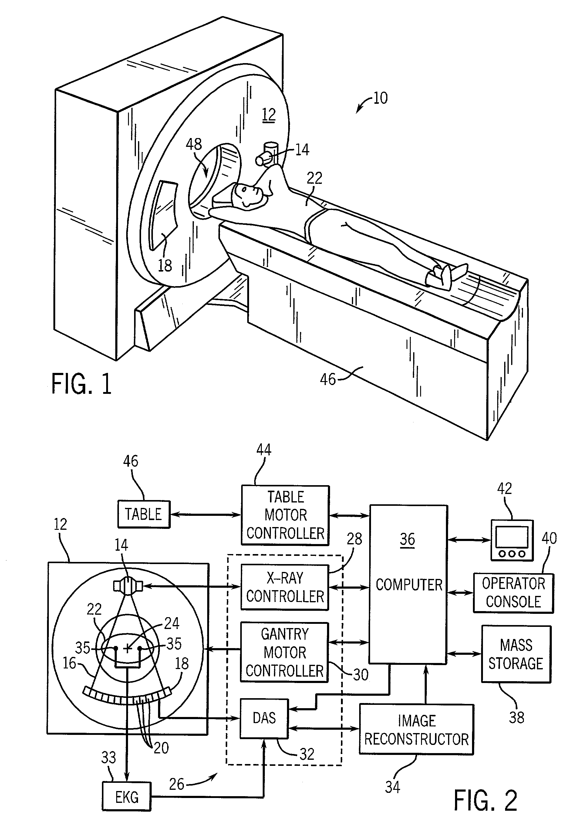 Method and apparatus of scoring an arterial obstruction