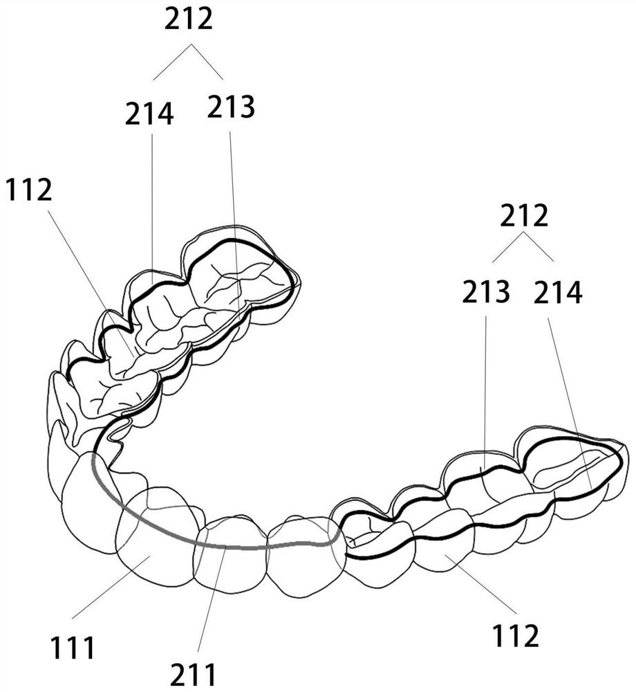 Orthodontic composite appliance, processed semi-finished product and processing method of orthodontic composite appliance