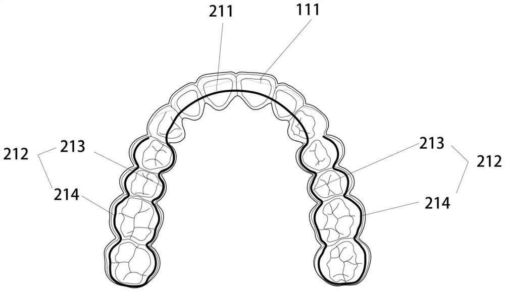 Orthodontic composite appliance, processed semi-finished product and processing method of orthodontic composite appliance