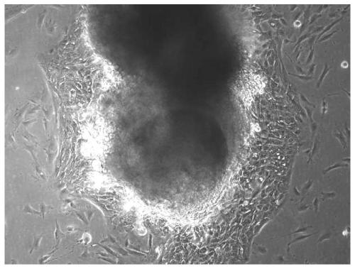 Epidermal cell culture medium and method for preparing fibroblasts and epidermal cells based on same tissue, and application thereof