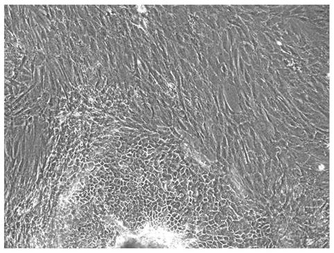 Epidermal cell culture medium and method for preparing fibroblasts and epidermal cells based on same tissue, and application thereof