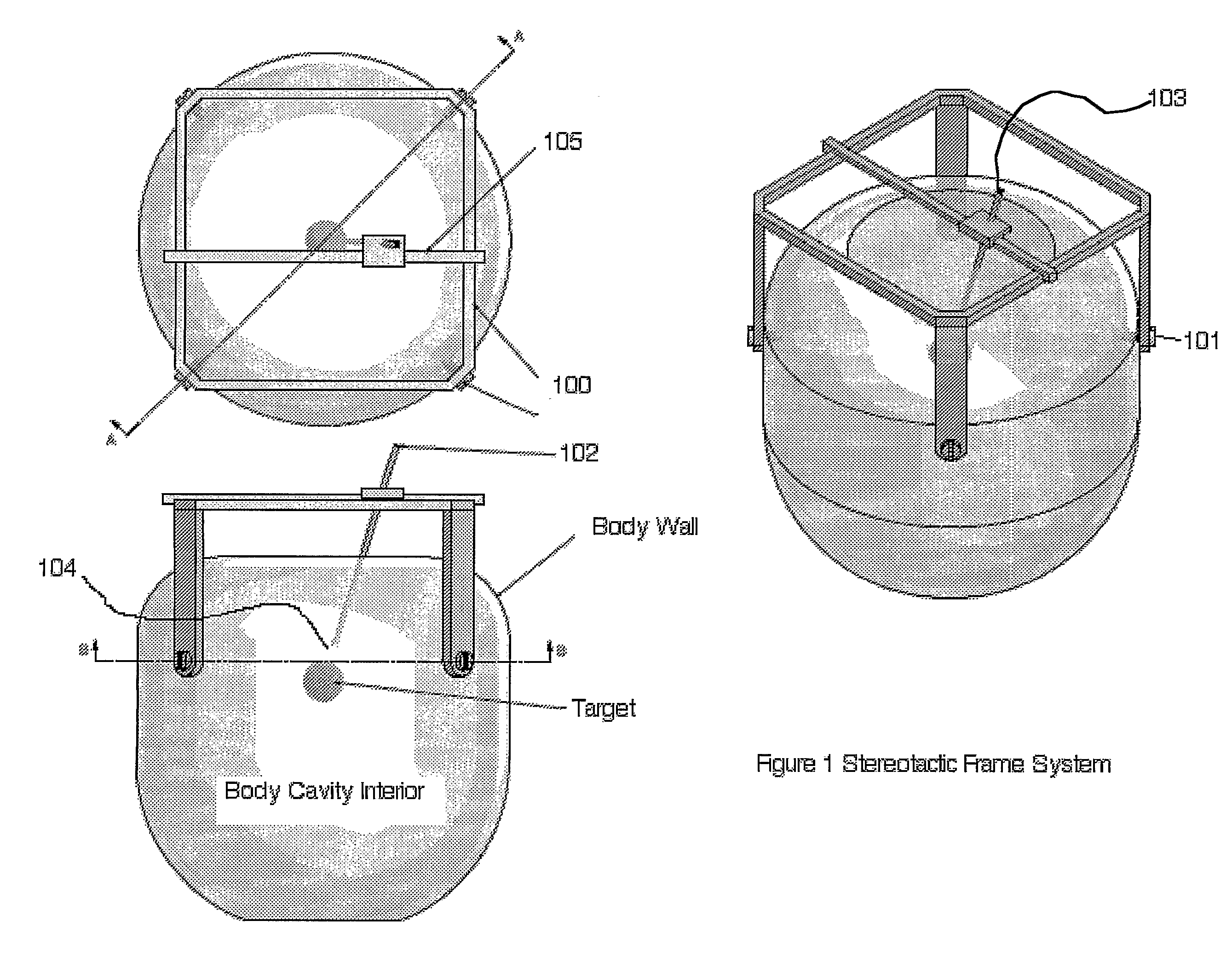 Percutaneous medical devices and methods